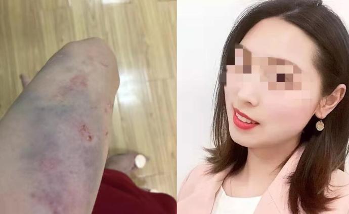 女教师坠亡被指遭家暴警方自杀不立案