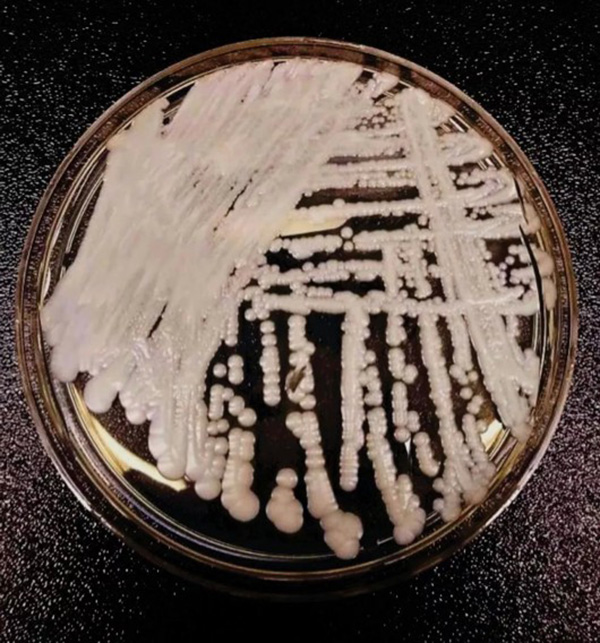北京疾控中心:超级真菌对公众健康不构成威胁