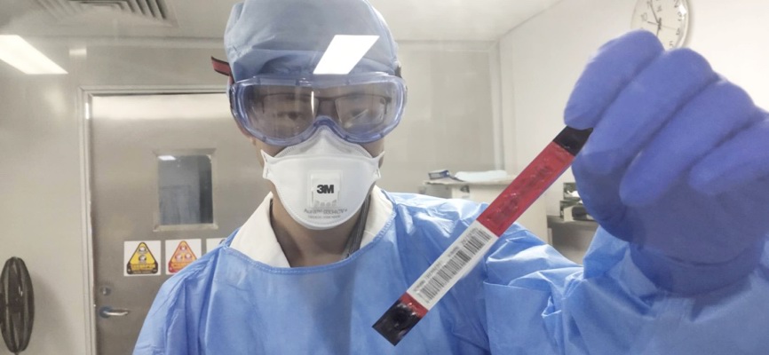 单人份2019新型冠状病毒IgM和IgG抗体化学发光检测试剂盒，已在深圳市第三人民医院（国家感染性疾病临床研究中心）完成了30例新冠病毒肺炎患者血液样本的检测。 深圳大学供图