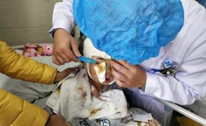 8岁女孩上学时遭8条狗撕咬，重伤住院