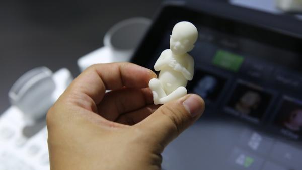 不一样的超声机：一键3D打印“宝宝”
