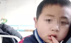幼童被遗弃河南省儿童医院：三天无人认领，听到“爷爷”才笑