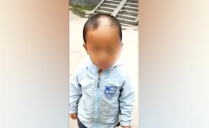 深圳再现疑似虐童事件：男孩眼角淤青头发脱落，街道办已介入