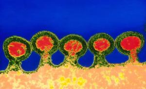 HIV宿主中发现新的抗病毒机制，有望成为新抗病毒药物靶点