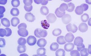 科技日报聚焦疟原虫疗法：是观察性研究，还是干预性治疗？