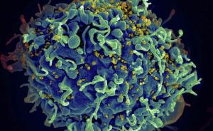 艾滋病病毒“帮凶”CCR5基因添新“罪证”：阻碍中风康复