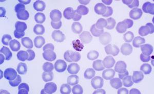 调查：疟原虫治癌可靠吗