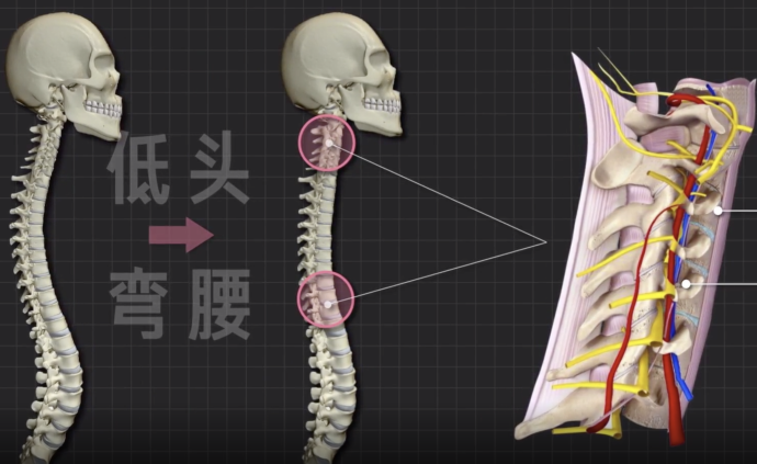 X 光如何看穿你的颈椎、腰椎病？