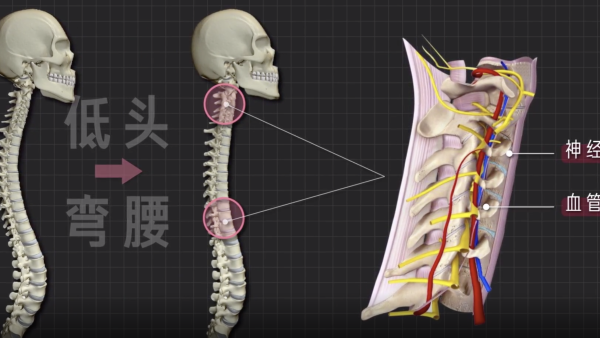 X 光如何看穿你的颈椎、腰椎病？