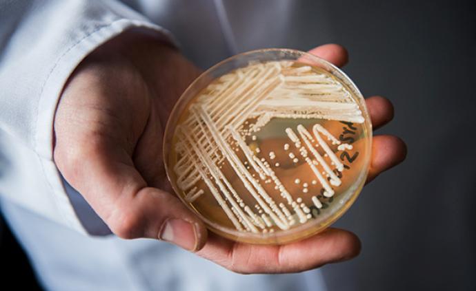 中国首例耳念珠菌感染病例发现者：耳念珠菌并非都是超级真菌