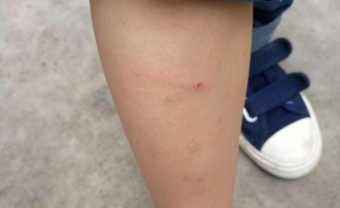 深圳一男孩被街坊养的狗咬伤两次，其父将狗打死遭索赔2万