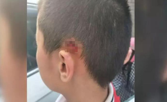 太原一民办校11岁男生遭男老师暴力推甩，脖颈处和耳朵受伤