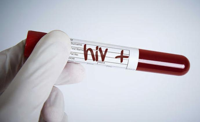 治愈艾滋第一步？科学家将HIV病毒从实验鼠DNA中清除 