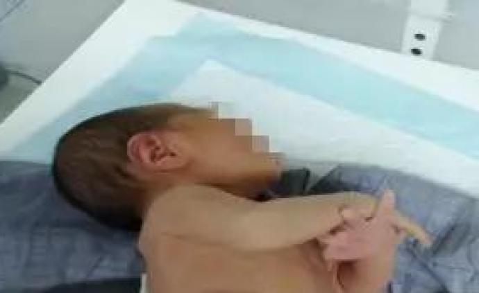 杭州一产妇在家分娩无人照料：9天没护理伤口脐带母子被送医