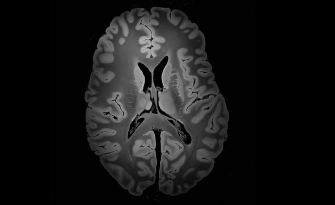 史上最清晰的人脑图：分辨率100微米