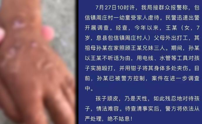 河南女童被祖母用老虎钳虐待，警方调查