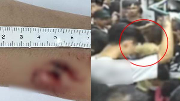 广州：女子地铁殴打乘客咬民警被逮捕