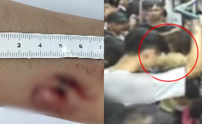 广州：女子地铁殴打乘客咬民警被逮捕