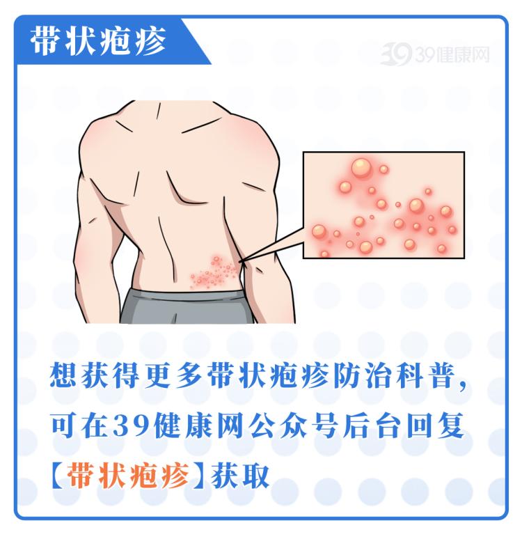 接触传染，所以不确定伴侣是否健康的前提下，大家一定要做好安全措施。虽然疱疹病毒目前无法根除，但做好以