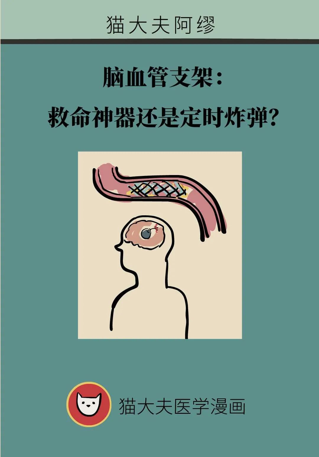 脑血管支架：救命神器还是定时炸弹？听听医生的大实话
