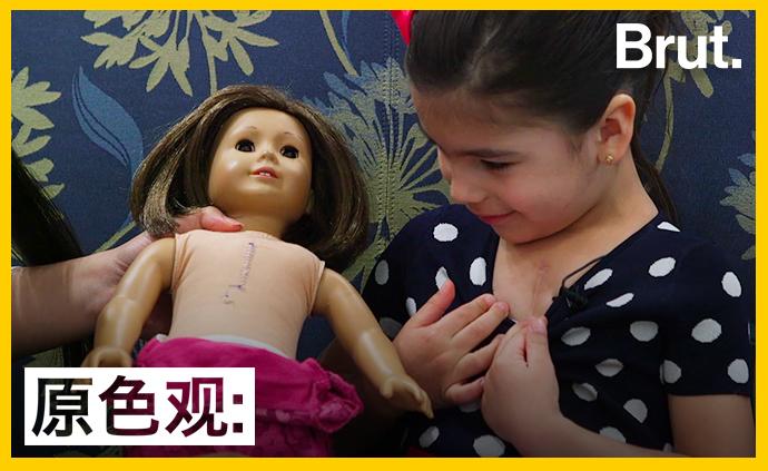 美國這家醫(yī)院,為什么要制作帶疤的洋娃娃?