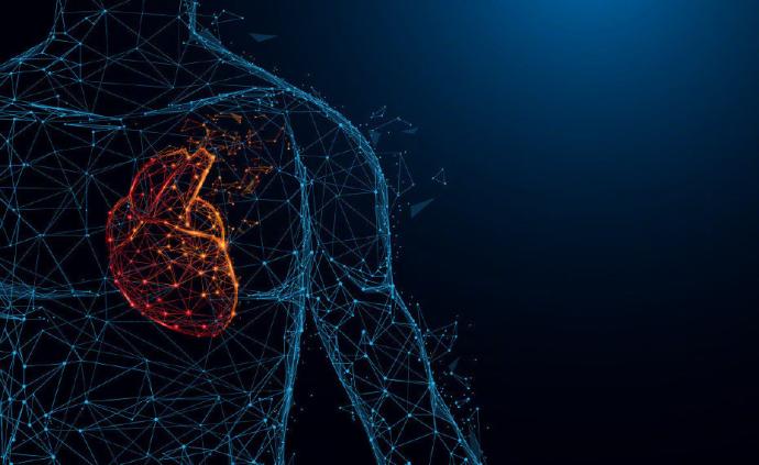 大型心脏病临床研究发现：支架搭桥不比药物治疗更有效
