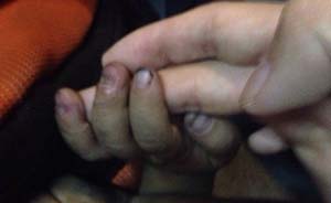 广东佛山三岁幼童被生父拔掉手指甲，上海作家陈岚介入被殴