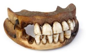读图｜滑铁卢战役200周年后，牙齿和战马的毛发成为纪念品