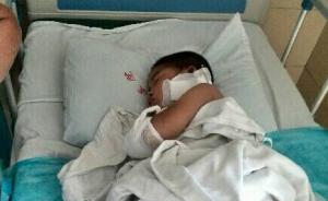 湖南5岁女童凌晨出门蹊跷受重伤：左耳与左手臂几乎都断了