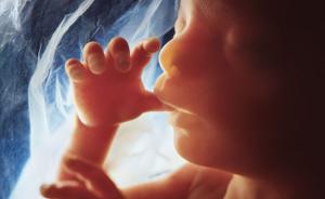 美国计划生育协会涉嫌盗卖堕胎胚胎器官，国会展开调查