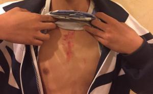 乌鲁木齐高中生深夜遭军训教官殴打致胸腹损伤，学校：已道歉