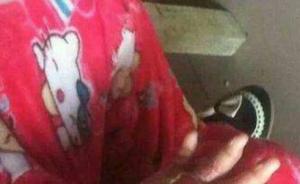 安徽一名6岁女童疑遭母亲虐待，官方：女童送医，其母被查