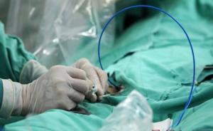 婴儿每分钟心跳250次，上海医生用导管插入心脏放电治愈