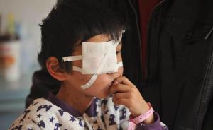 安徽一男子抠瞎七岁男童眼只因“嫌其吵闹”，警方：已刑拘