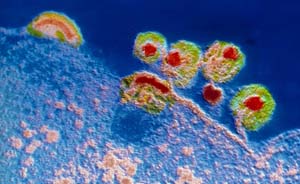 艾滋病毒侵入人体基因内？美国科学家首次实现彻底清除