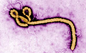 苏州完成“埃博拉”病毒关键基因合成，防治疫情第一步