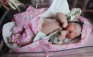 13.6斤！浙江一产妇生下巨婴，孕期“醒着几乎都在吃”