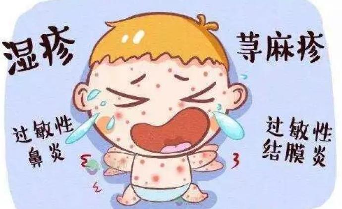 喘息、鼻炎和特应性湿疹，近半数中国城市儿童患过敏问题