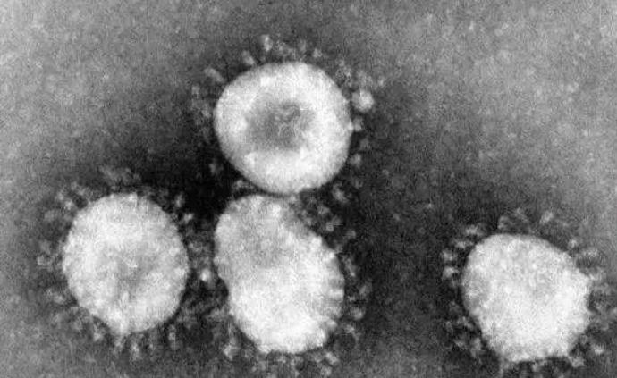 粪便中发现病毒核酸，可能通过粪便传播吗？屁中有没有病毒？