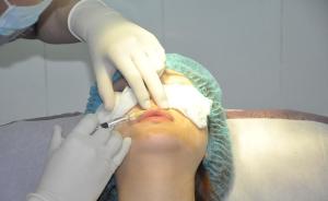美容师注射玻尿酸操作不当，浙江一女子眼动脉栓塞致右眼失明
