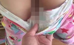 福州5岁女童下体青肿流血自称摔伤，幼儿园视频少了4分钟
