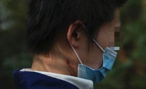 “北京老虎咬人事件”受伤女子露面，称看到有车逗留才下的车