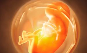 胎儿医学——子宫内为胎儿手术