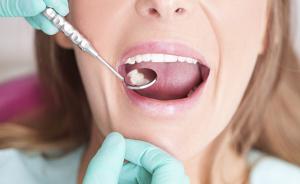 专访丨牙周病治疗不就是洗牙吗？束蓉：“过度治疗”是误解