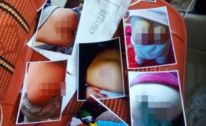 十几名小学生屁股被打肿3天未消，临沂市教育局：校方在调查