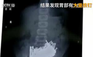 视频｜江西初三学生长期遭同学欺凌，吞1.4斤铁钉欲自杀