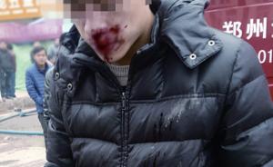 郑州南曹乡一处厂房失火，记者采访遭10余男子殴打流血不止