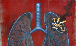 吸烟指数>400须警惕肺癌，如何进行三级预防