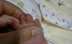 宜宾一孕妇生下手足畸形儿质疑医院6次彩超存漏诊，医院调查