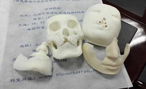 27岁女子在上海“换脸”：幼年毁容，医生在其胸部“造脸”